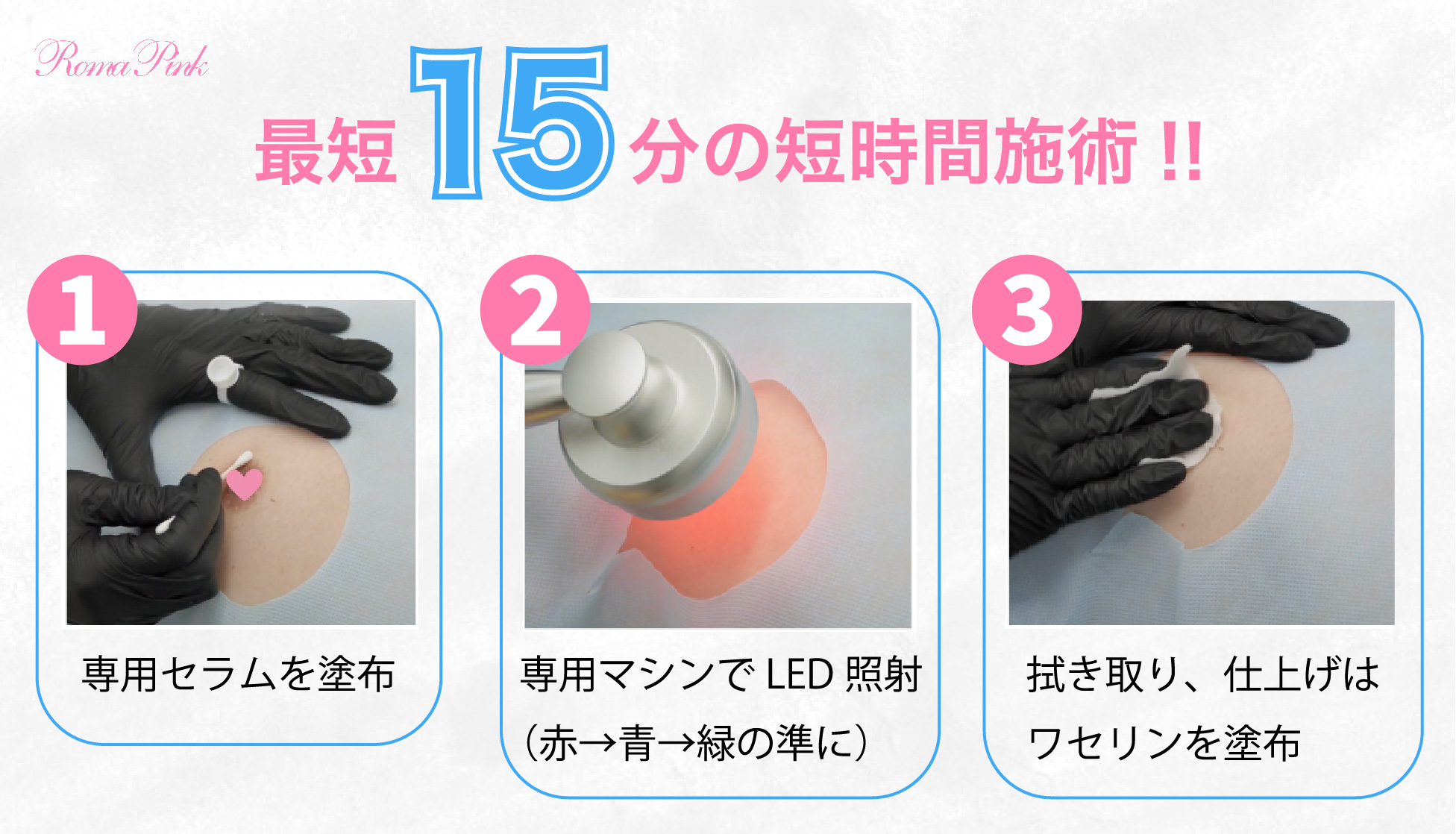 最短１５分の短縮施術