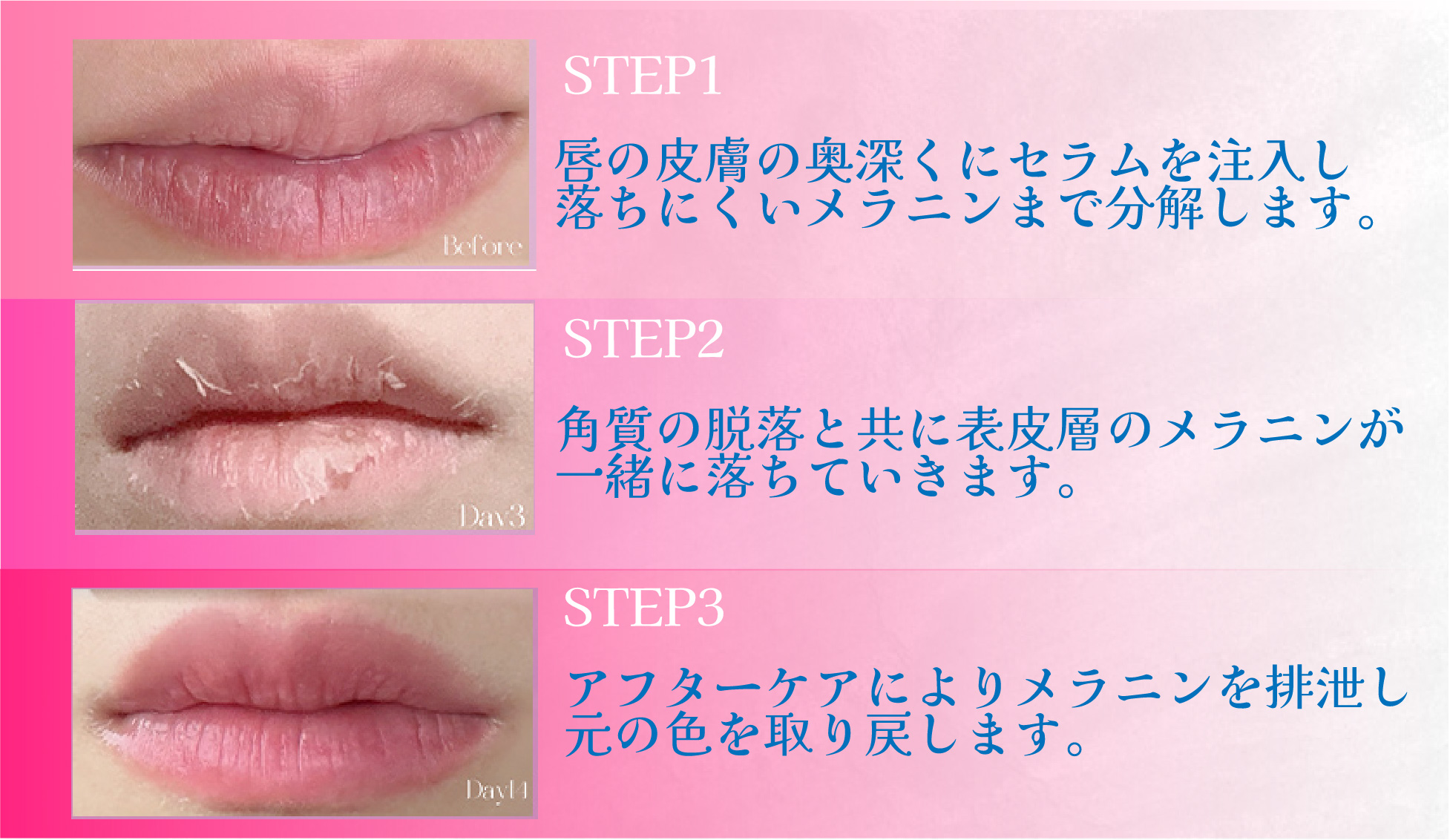 唇の症状