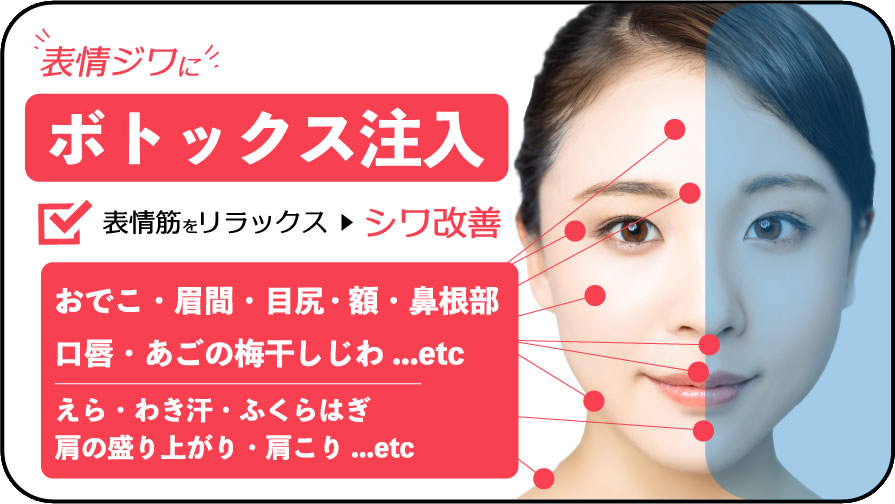 ボトックス注入1